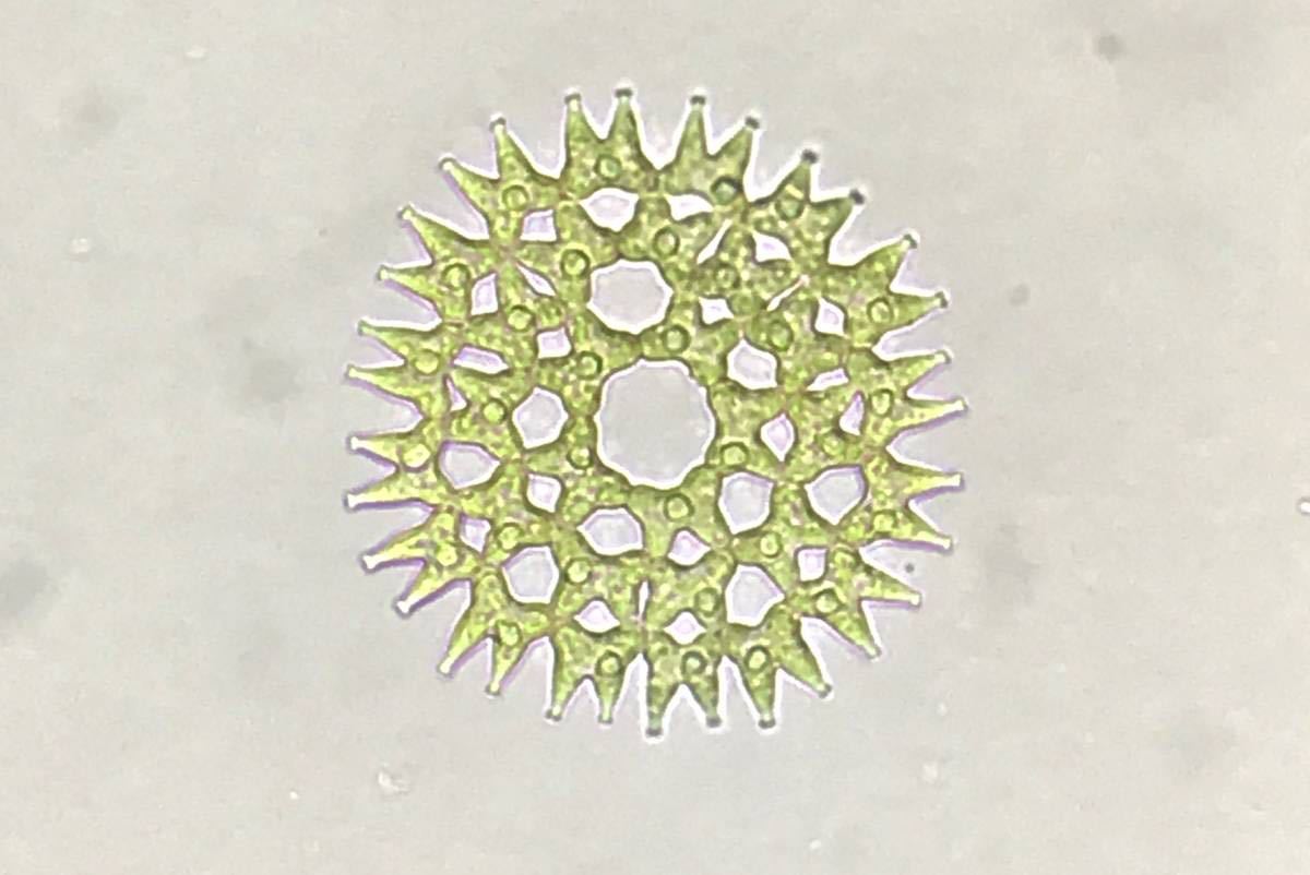 『フタヅノクンショウモ』　淡水藻類　プランクトン 顕微鏡観察 自由研究などに_画像2