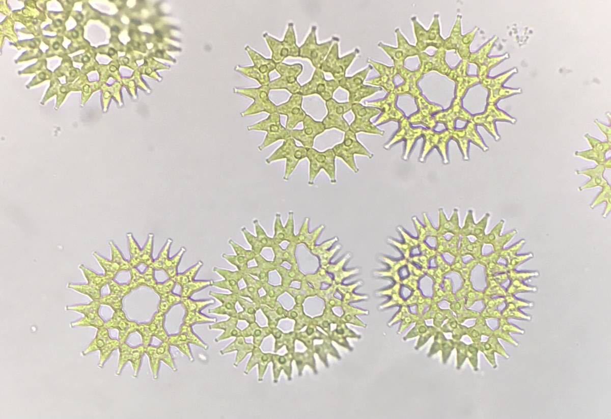 『フタヅノクンショウモ』　淡水藻類　プランクトン 顕微鏡観察 自由研究などに_画像4