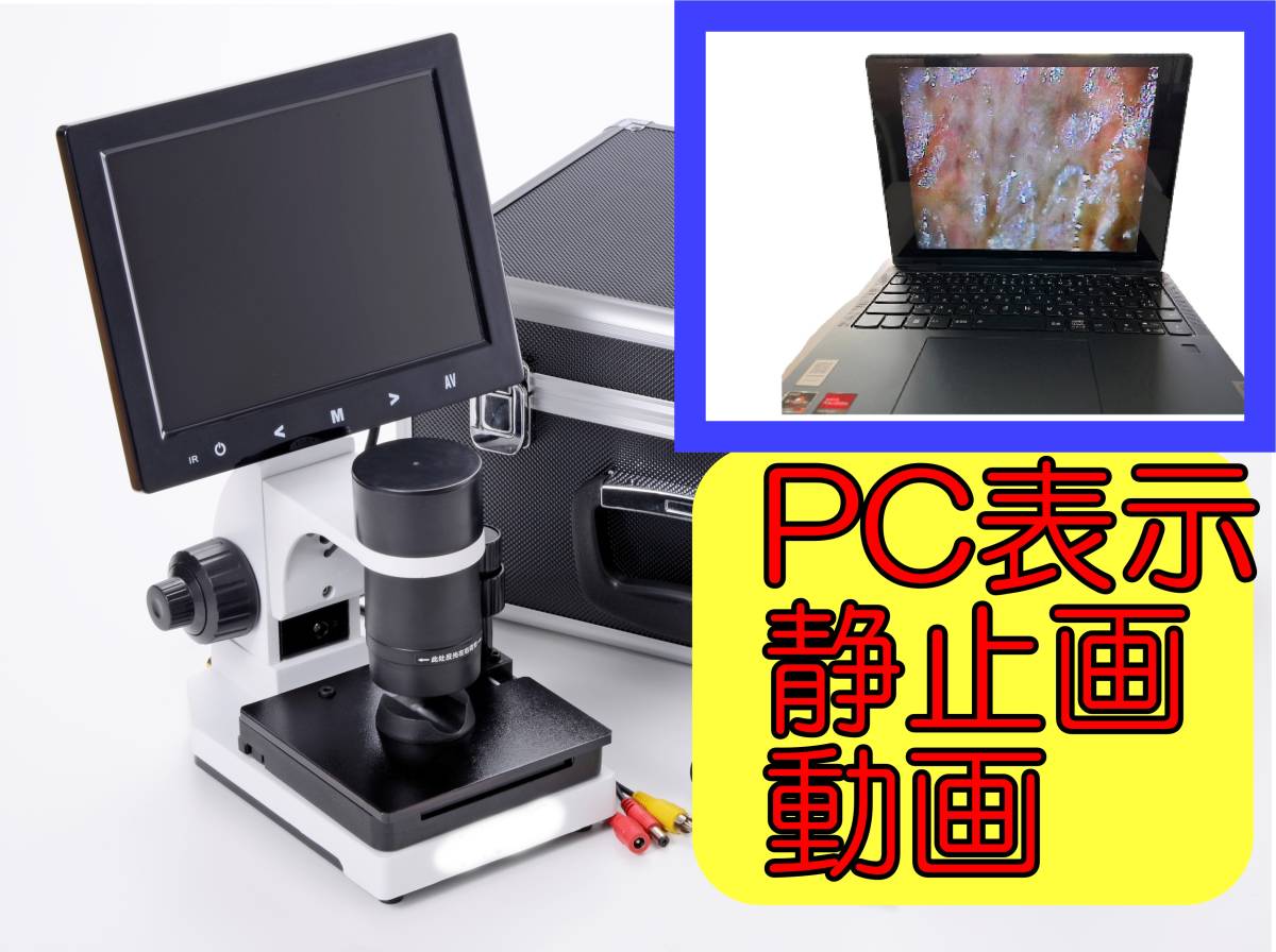 personal computer . see .. scope wool small blood vessel scope 8 -inch 600 times safe 1 year guarantee convenient power supply ON/OFF adaptor attaching microscope takkyubin (home delivery service) (EAZY) shipping 