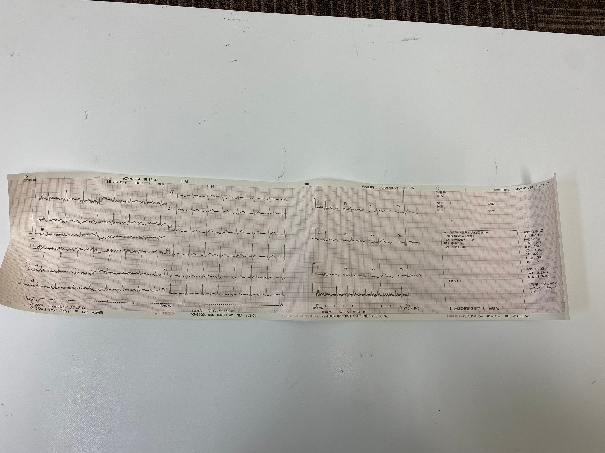 [ б/у ]fkda электронный сердце электро- итого автоматика .. имеется кровяное давление . волна инспекция оборудование ba Sera VaSera VS-1500AE