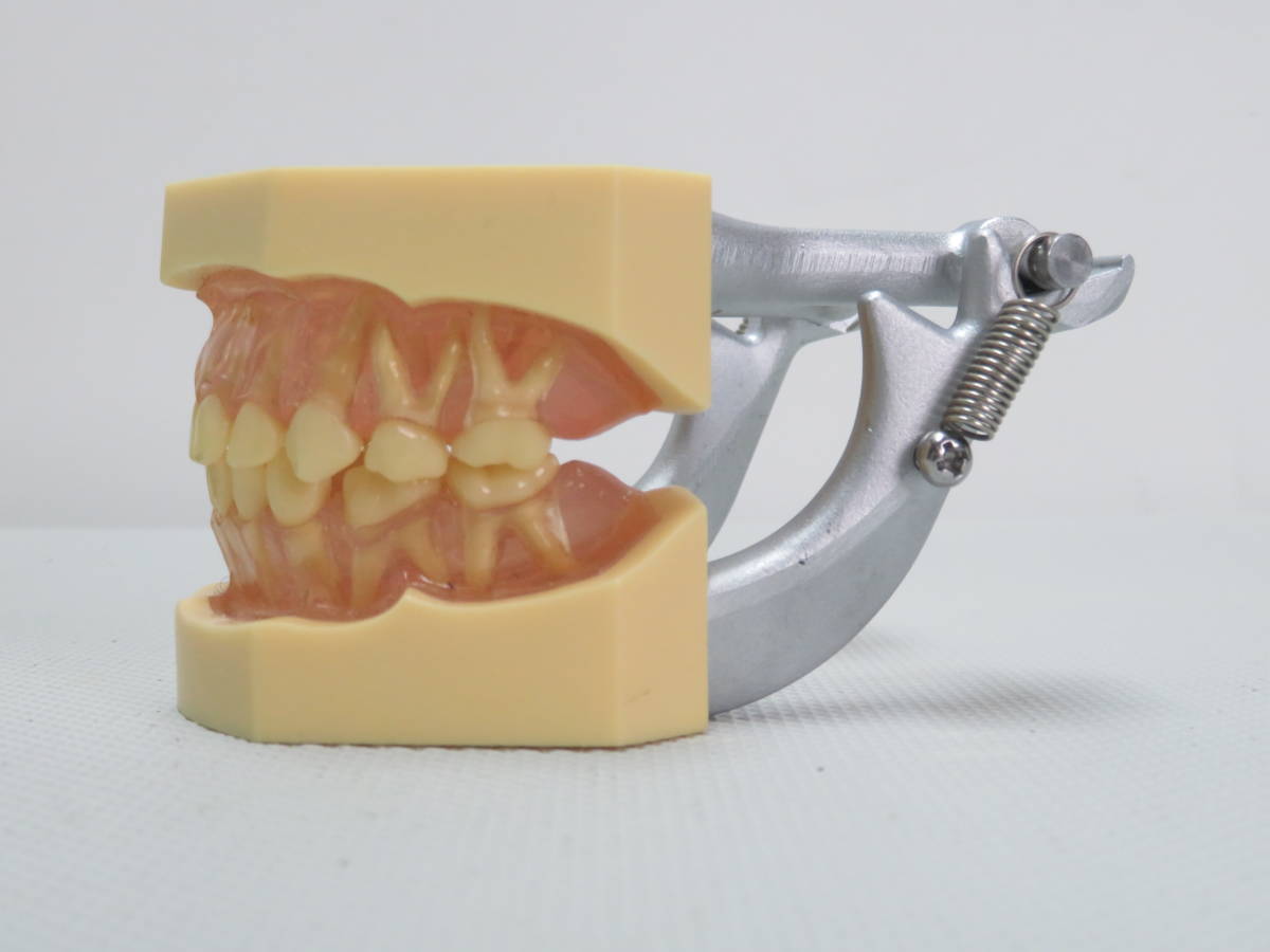 [F834] 送料込! 歯科技工 小児 顎模型 スタディモデル 歯科医師国家試験用 複製模型歯着脱顎模型(乳歯列)_画像2