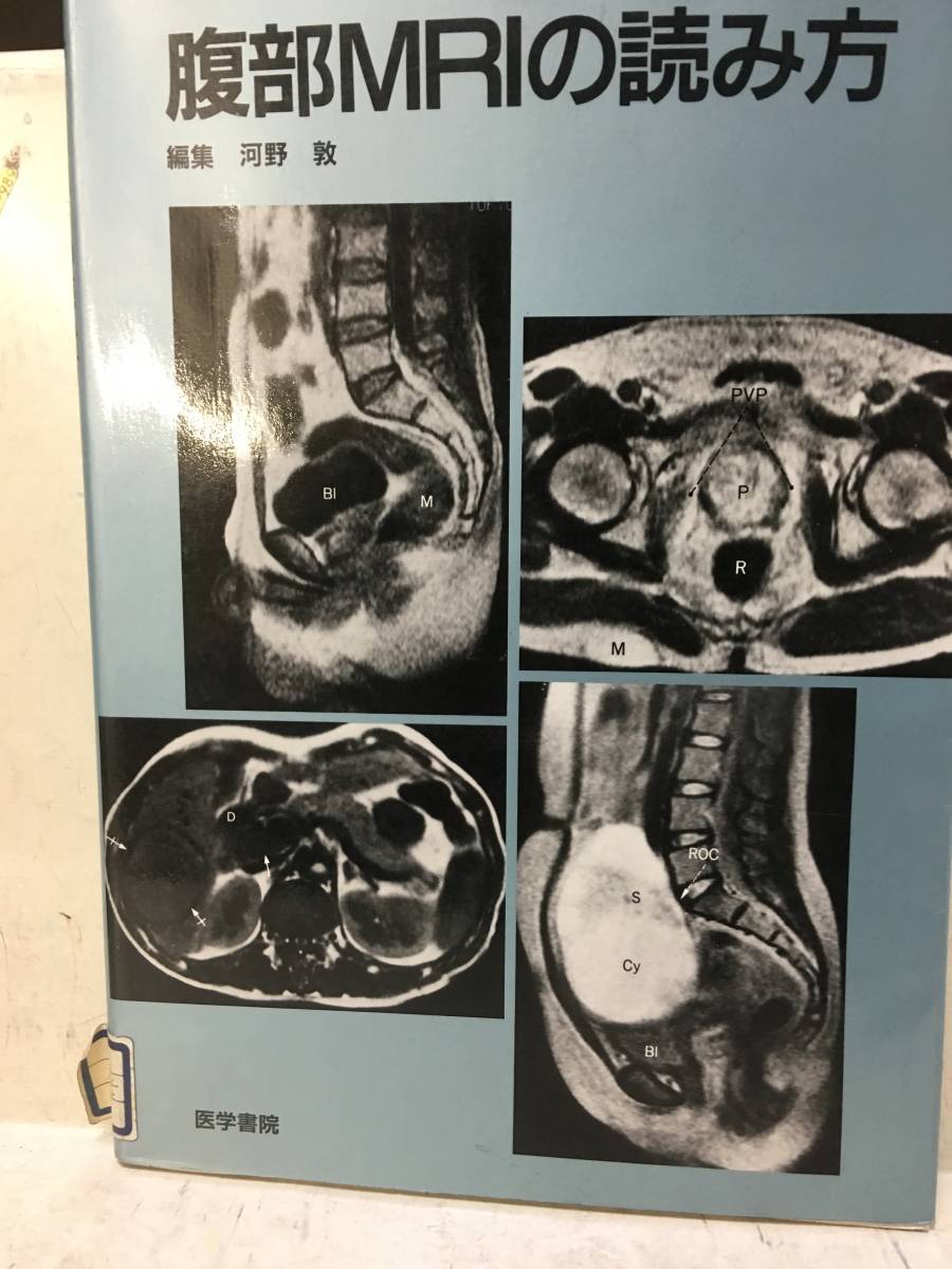 即決　病院払下げ本　腹部MRIの読み方 (河野 敦)_画像1