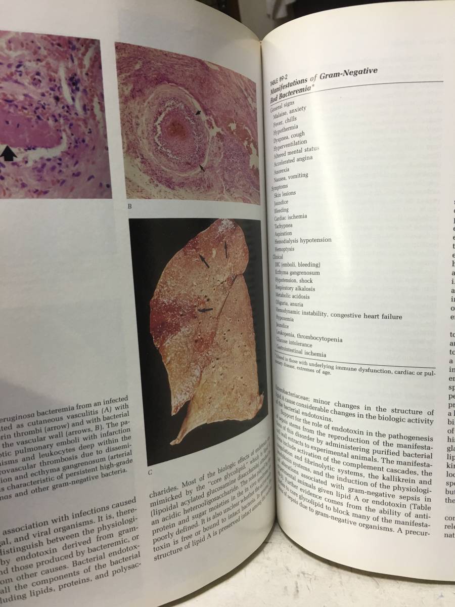 即決　病院払下げ本　Pulmonary Diseases and Disorders 第二版　ボリューム2(Alfred P. Fishman)医学洋書・大型本_画像5