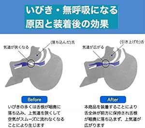 Trust Contact 舌用マウスピース 鼻呼吸 いびき防止 グッズ 睡眠 いびき 取扱説明書 舌 マウスピー_画像3