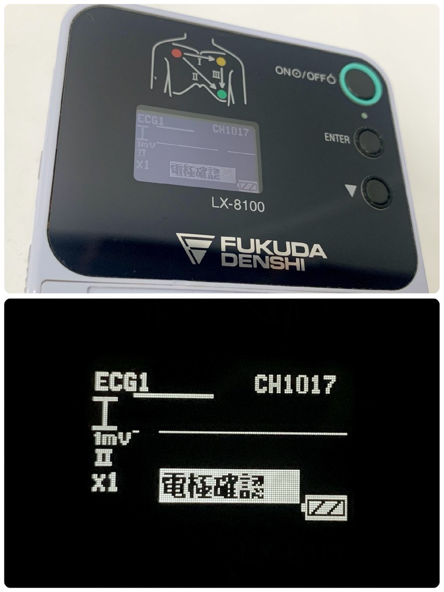 フクダ電子 LX-8100 テレメトリー式心電送信機 心電・呼吸送信機　FUKUDADENSHI_画像2