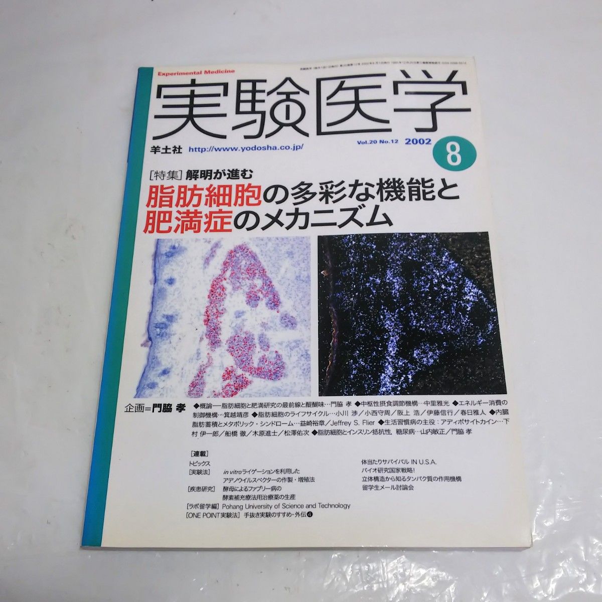 実験医学 Vol.20 No.12 2002.8 脂肪細胞の多彩な機能と肥満症のメカニズム 羊土社