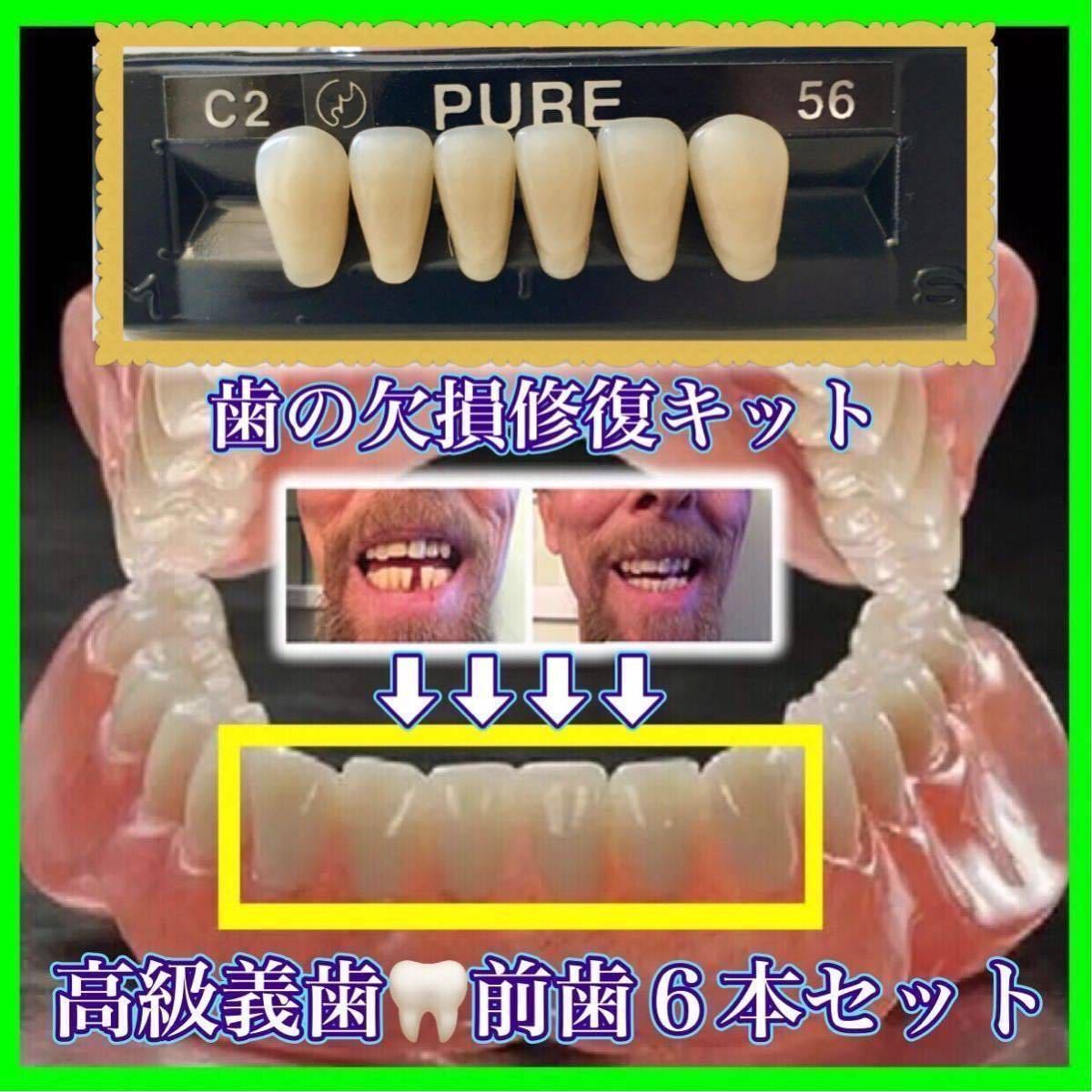 正規品 （前歯下段６本）歯科人工歯 歯の欠損修復 高品質樹脂製 高級義歯全６個セット 義歯 仮歯 付け歯 入れ歯 インスタントスマイル 4