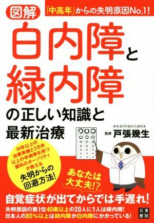 図解　白内障と緑内障の正しい知識と最新治療／戸張幾生_画像1