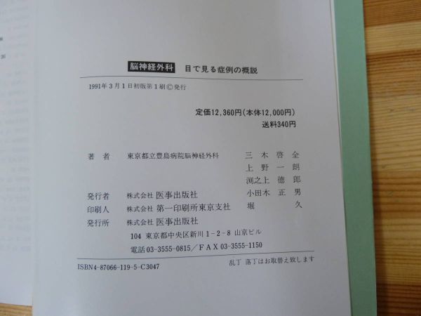 T38▽脳神経外科 目で見る症例と概説 医事出版社 三木啓全 上野一朗 渕之上徳郎 脳腫瘍 外傷 CT 硬膜下血腫 頭蓋骨骨折 モヤモヤ病 231219_画像9