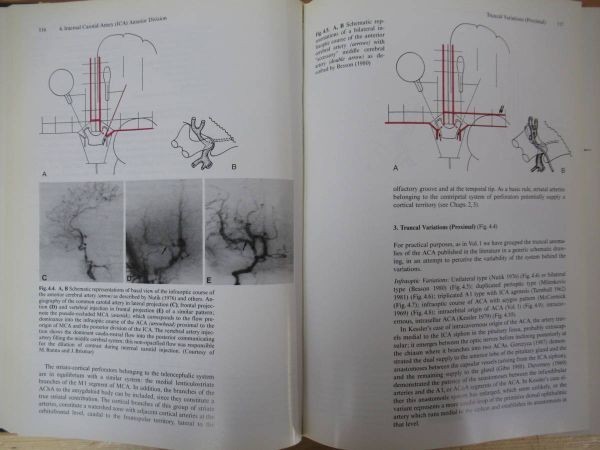 L93●洋書 Surgical Neuro angiography Volume 3 Functional Vascular Anatomy of Brain Spinal Cord and Spine 医学書　 230306_画像6