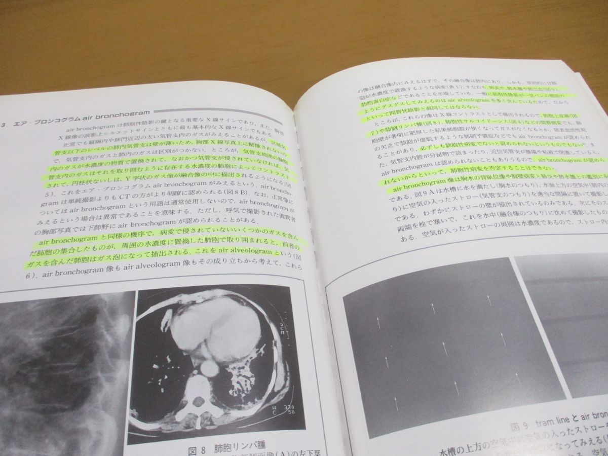 ●01)【同梱不可】胸部X線写真の読み方/大場覚/中外医学社/第2版/2002年/A_画像5