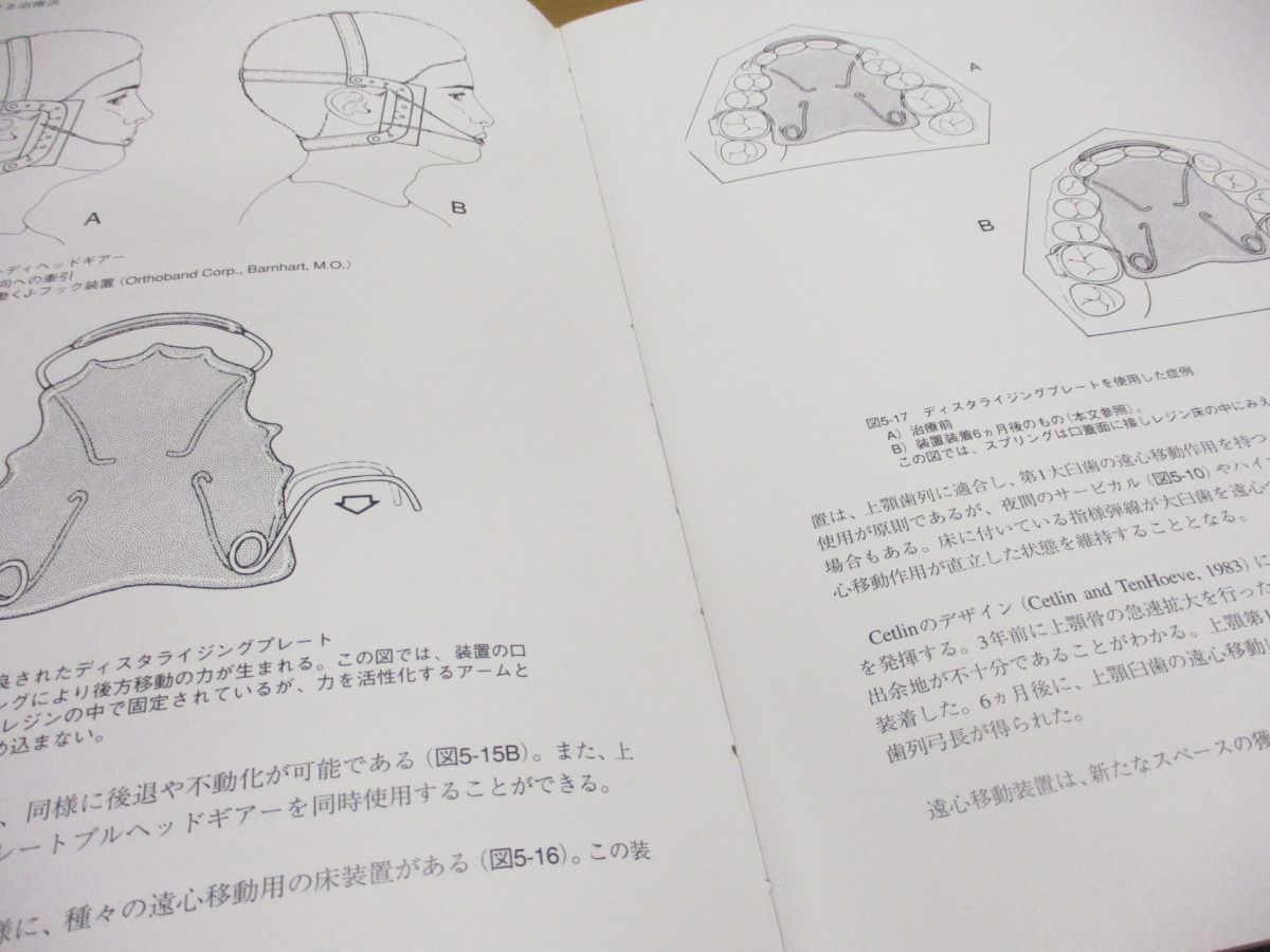 ▲01)【同梱不可】混合歯列期の矯正治療/宮島邦彰/黒田敬之/東京臨床出版/1998年発行/A_画像4