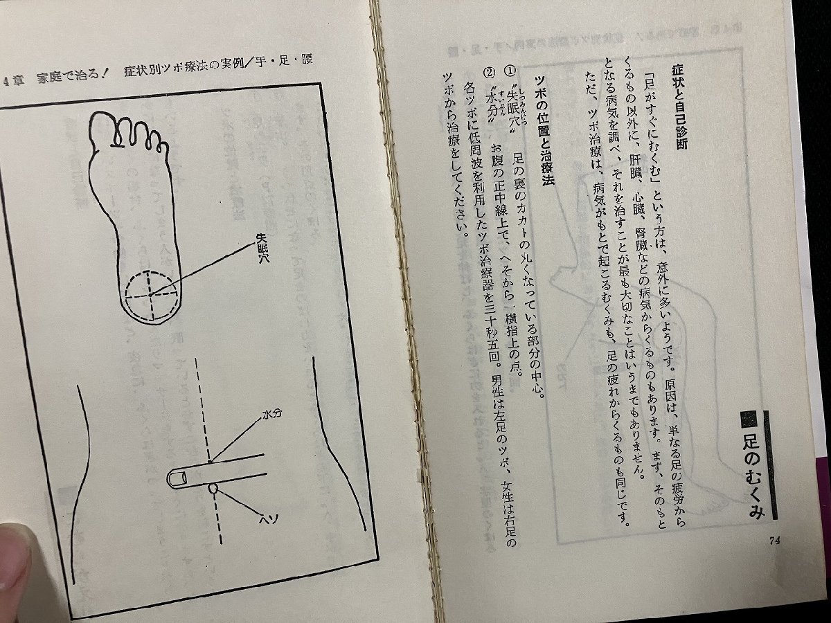 ｇ▼　難あり　あなたでもできる中国鍼療法　ツボ探知百発百中　著・刑部忠和　昭和58年初版　現代ブック社　/D02_画像4