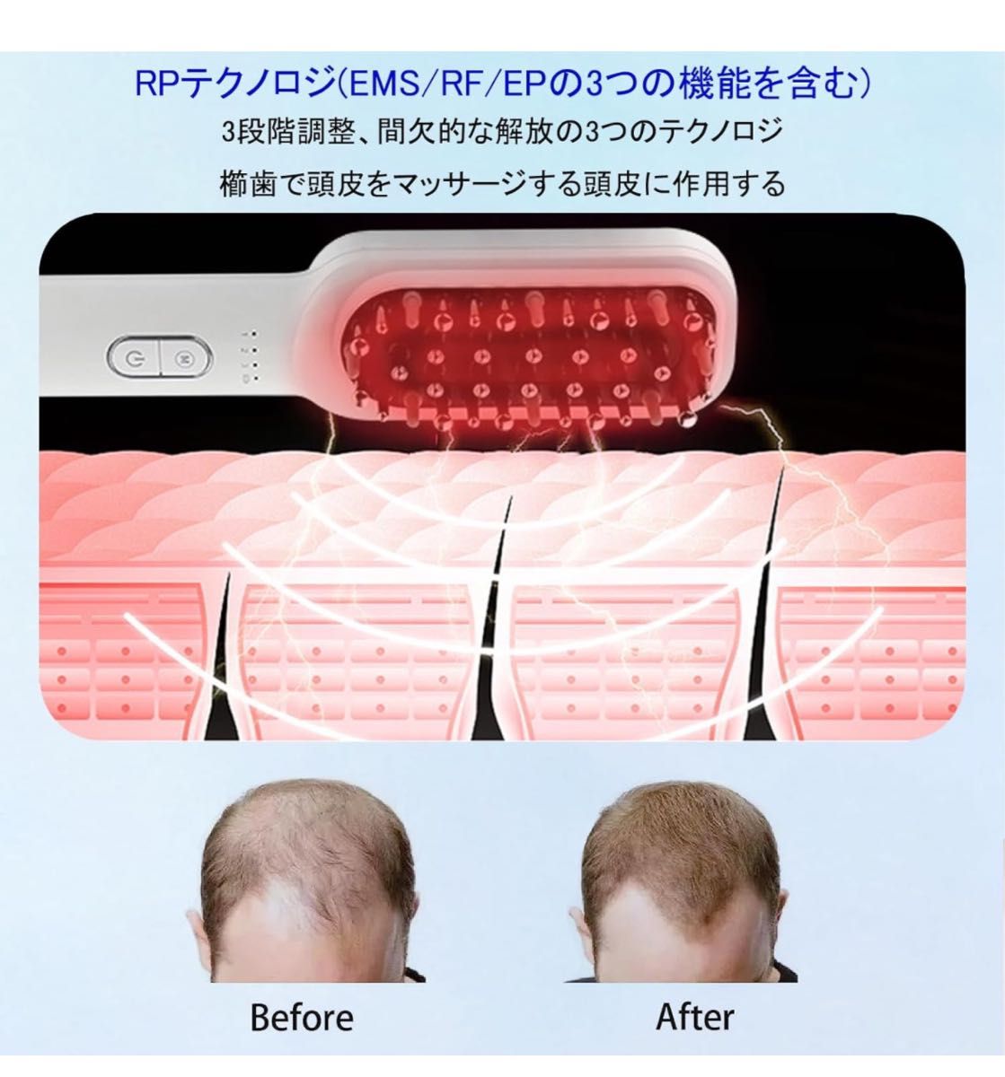 美顔器 電気ブラシ 電動頭皮ブラシ 頭皮 emsブラシ RF振動 LED