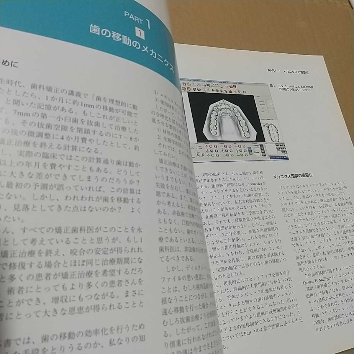 美品『効率的歯の移動による矯正歯科治療』久保田隆朗★メカニクス/ブラケット/アンカースクリュー/インプラント/症例集/歯列矯正/TAD/骨_画像3