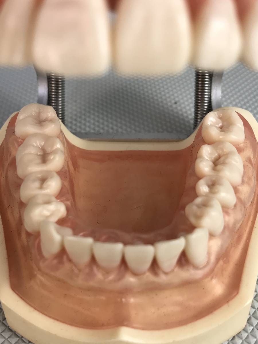 A9826●NISSIN ニッシン DENTAL MODEL デンタルモデル 162H-2 ゼツZ-1 歯科模型 歯科材料 歯医者 模型 歯 中古の画像7