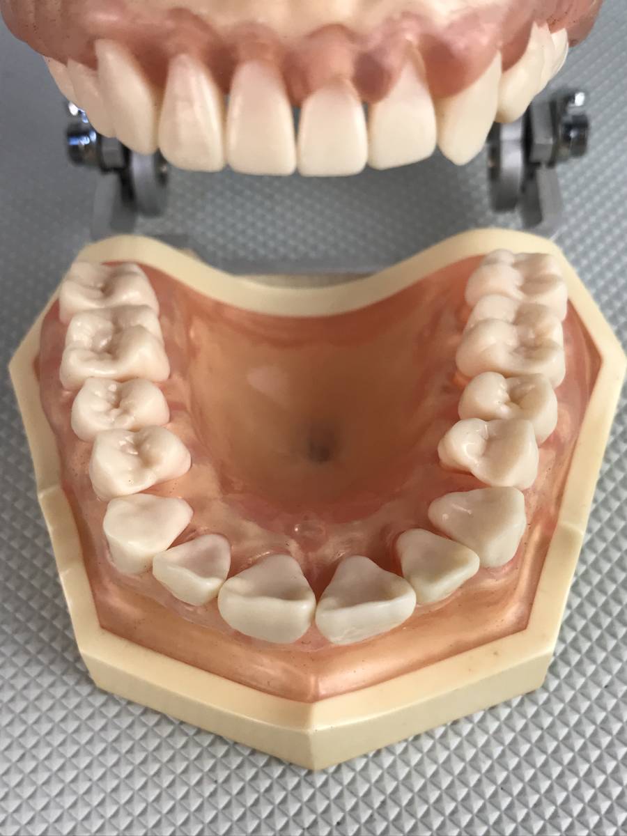 A9826●NISSIN ニッシン DENTAL MODEL デンタルモデル 162H-2 ゼツZ-1 歯科模型 歯科材料 歯医者 模型 歯 中古の画像8