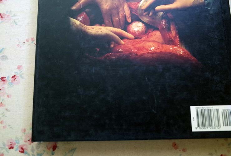 46097/外科手術 Max Aguilera-Hellweg 写真集 The Sacred Heart Atlas of the Body Seen Through Invasive Surgery 1997年 Bulfinch 人体の画像8