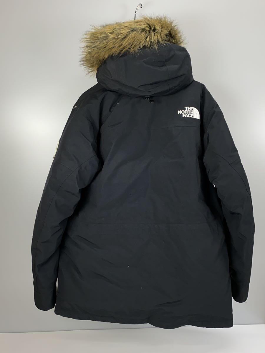 THE NORTH FACE◆ANTARCTICA PARKA_アンタークティカ パーカ/XL/ゴアテックス/BLK_画像2