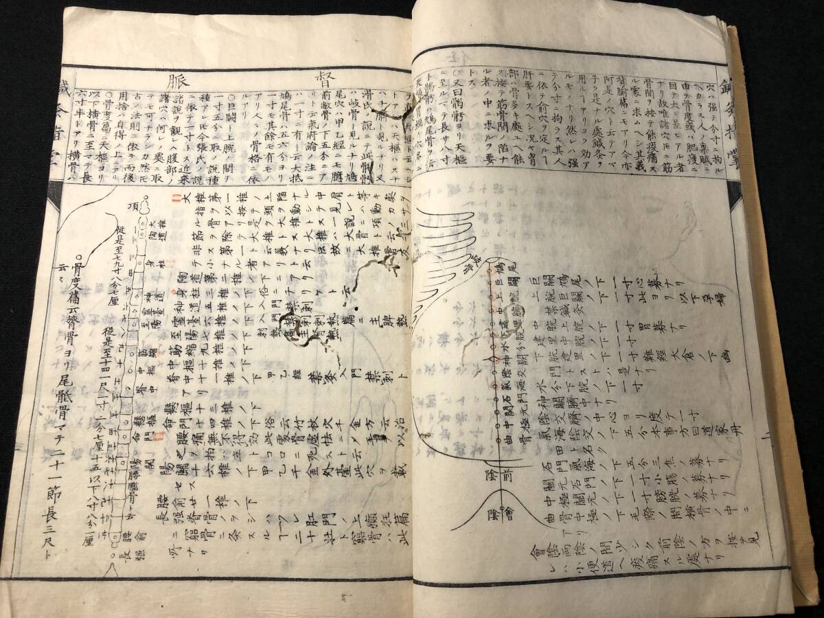 2853針灸 医学 医療 中国 漢籍 絵入 図入 ■鍼灸指掌■ 今邨了菴 江戸期 木版画 木版 版画 和本浮世絵ukiyoe古書古文書骨董古美術_画像6