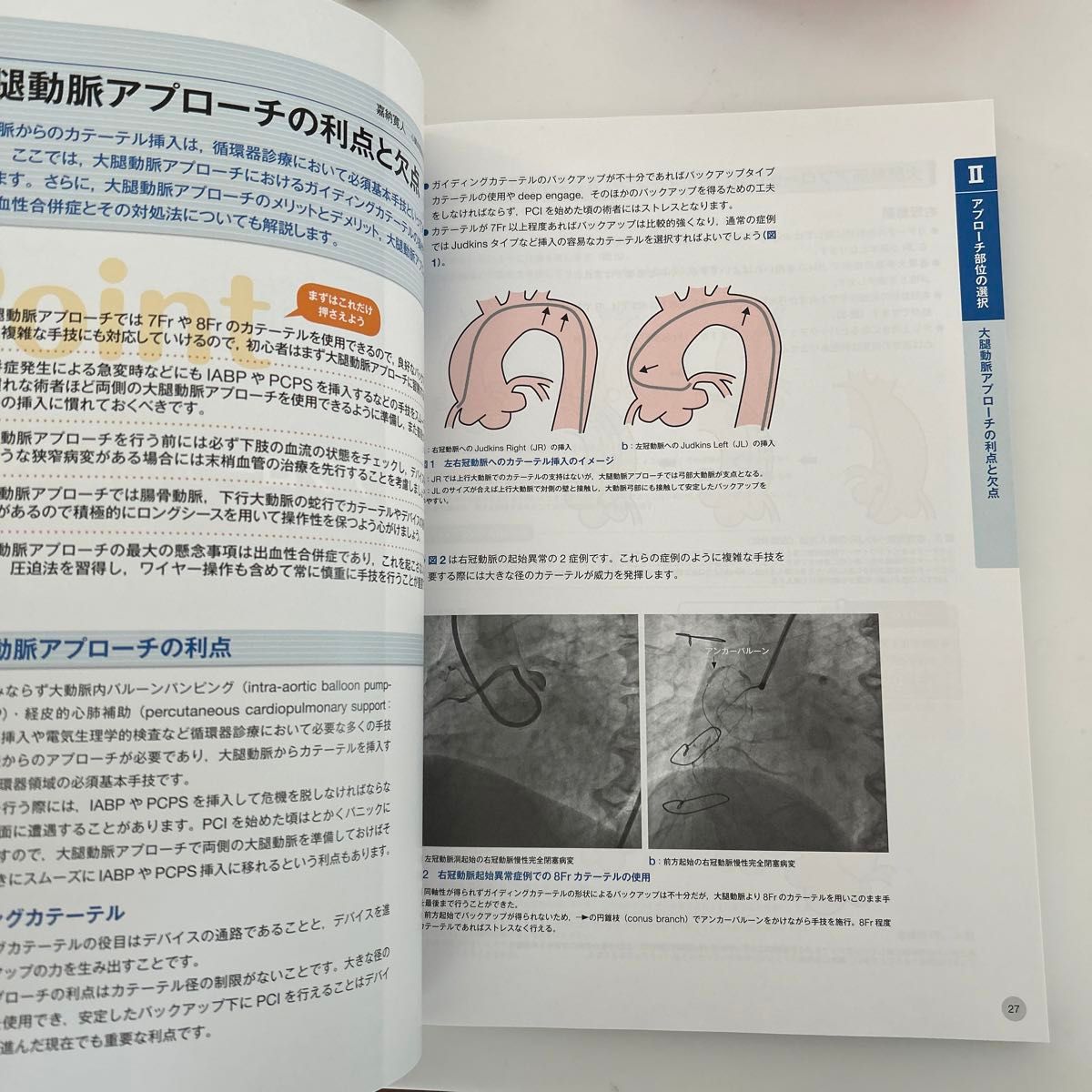 これから始めるPCI 看護　医療　カテーテル　心臓　循環器