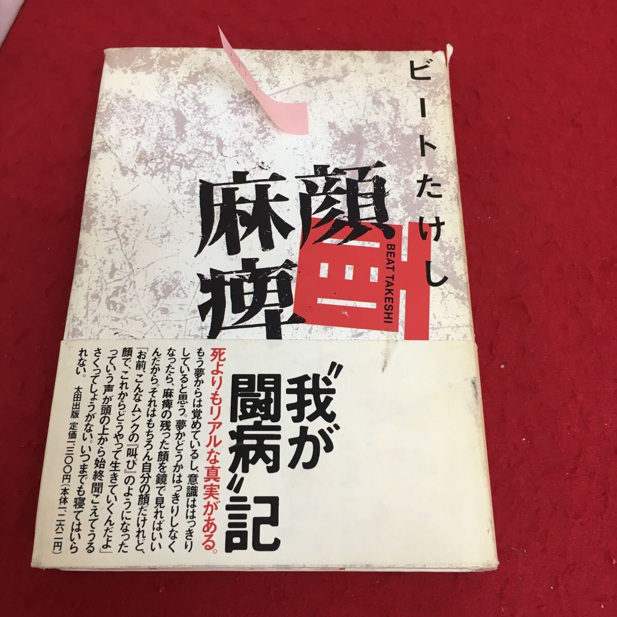 f-667 顔面麻痺 1994年12月21日第3版発行 集中治療室 一般病棟 退院記者会見全記録 ※3 _画像1