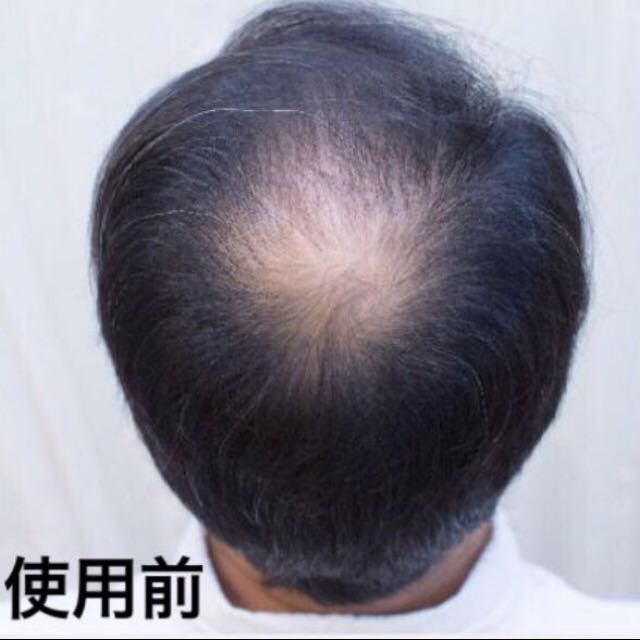 白髪生え際分け目つむじ薄毛禿げ隠しマイクロヘアーパウダー増毛ふりかけカツラスーパーミリオンヘアーウイッグティップトップ薄毛カバーに