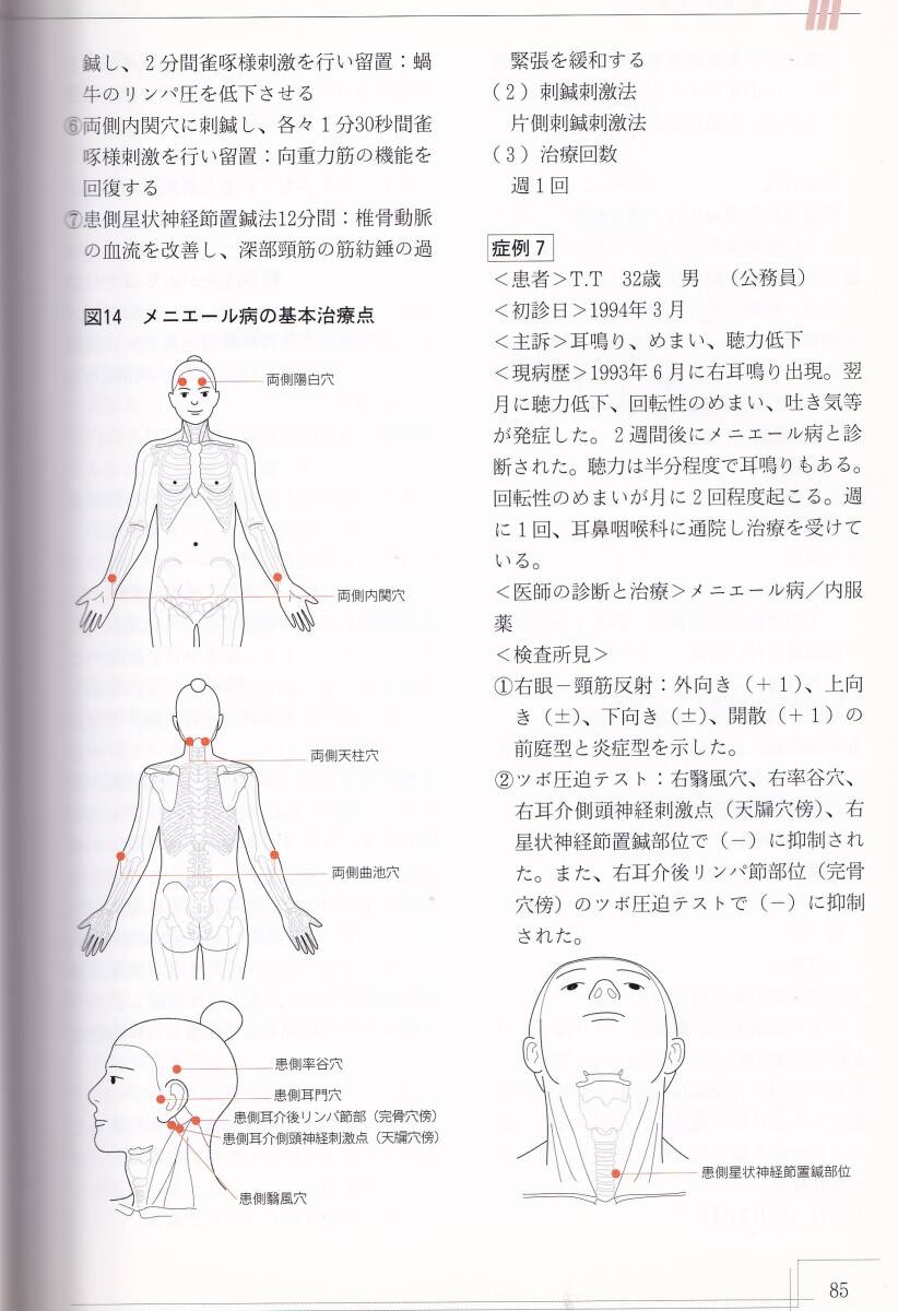 自律神経に優しい星状神経節置鍼法および上頸神経節置鍼法 西洋医療との併用を目指して. 渡邊一男著　(鍼灸_画像7