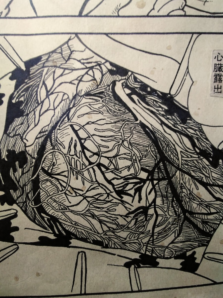 【手描き保証/ブラックジャック】手塚治虫 出版社から入手 生原稿 原画 模写　鉄腕アトム 火の鳥リボンの騎士 収集家初蔵出し 昭和レトロ_画像10