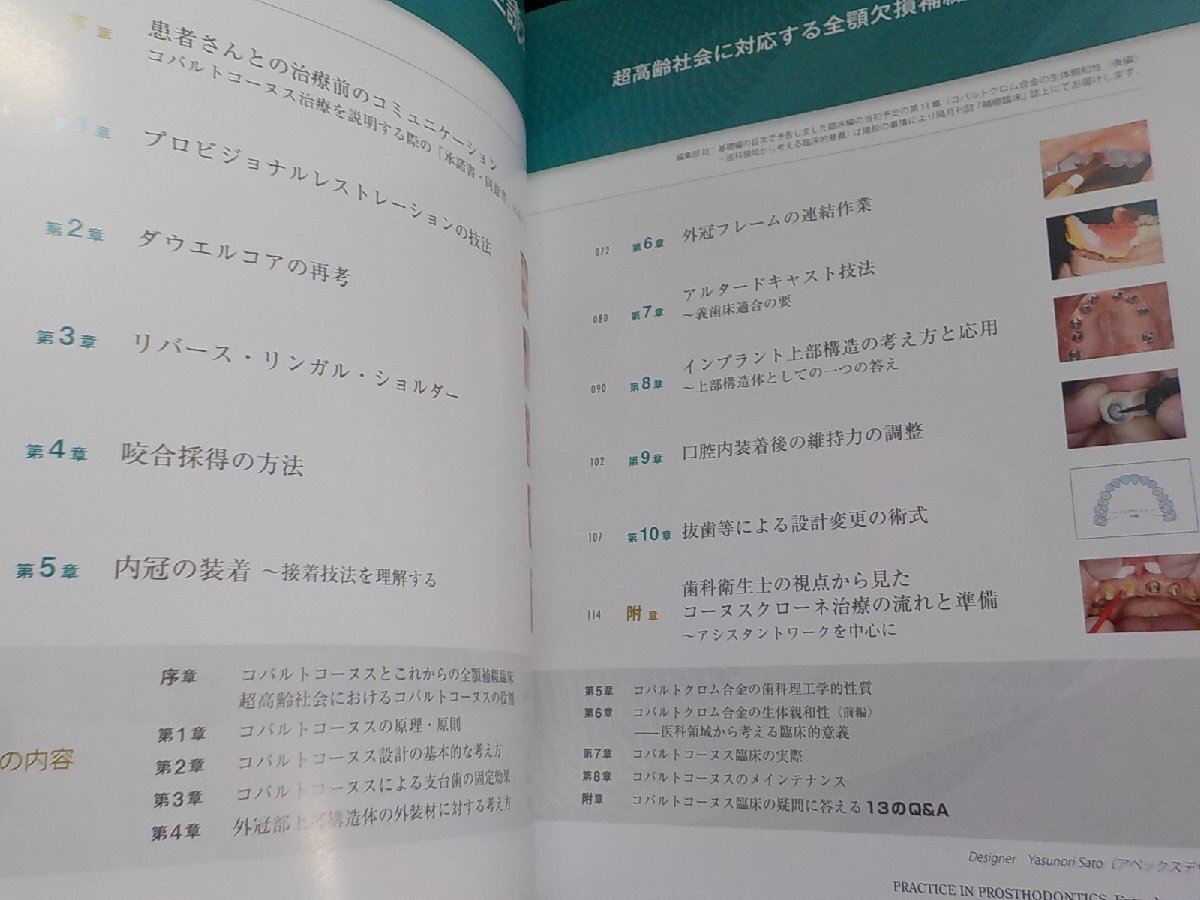 2K1128◆補綴臨床別冊 コバルトコーヌス完全読本 超高齢社会に対応する全顎欠損補綴の新たな一手 臨床編(ク）_画像2