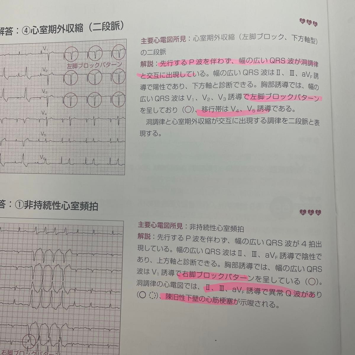 心電図検定公式問題集&ガイド 改訂3版|Yahoo!フリマ(旧PayPay 心電図検定公式問題集&ガイド 改訂3版|Yahoo!フリマ(旧PayPay