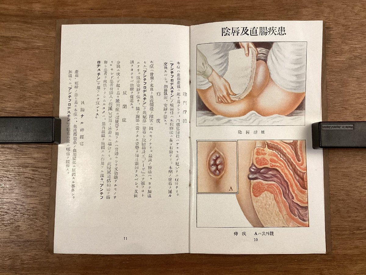 RR-6478■送料込■妊娠 其の微候及び合併症 妊娠 人体 病気 仕組 本 雑誌 写真 古本 冊子 古書 古文書 印刷物/くOKら_画像7