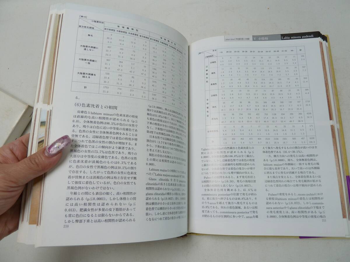 ＠日本性科学体系Ⅰ 日本女性の外性器 統計学的形態論 笠井寛司 外箱・帯付 1997年第5版 古書 医学書 専門書の画像7