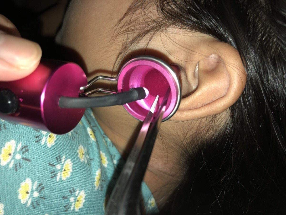 耳穴掃除セット 耳鏡 LEDライト付き 先端細ピンセット付き 2点セット / 医療用ライト 耳掃除器具 子供・大人兼用 (ピンク)_画像5