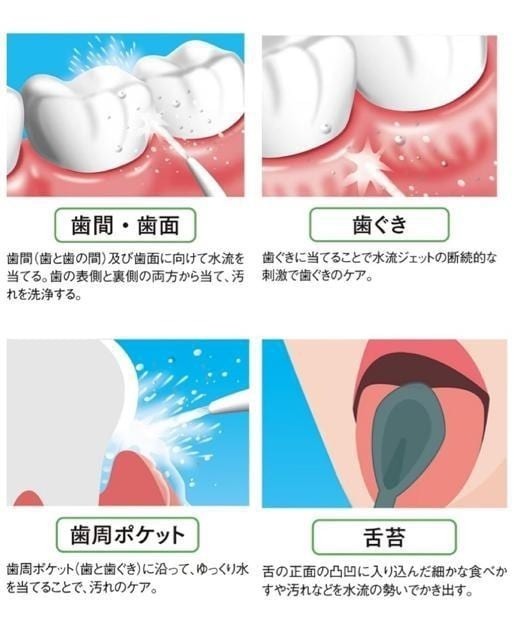 新品☆口腔洗浄器♪ウォータークリーンジェット♪歯磨きに＋α☆u170