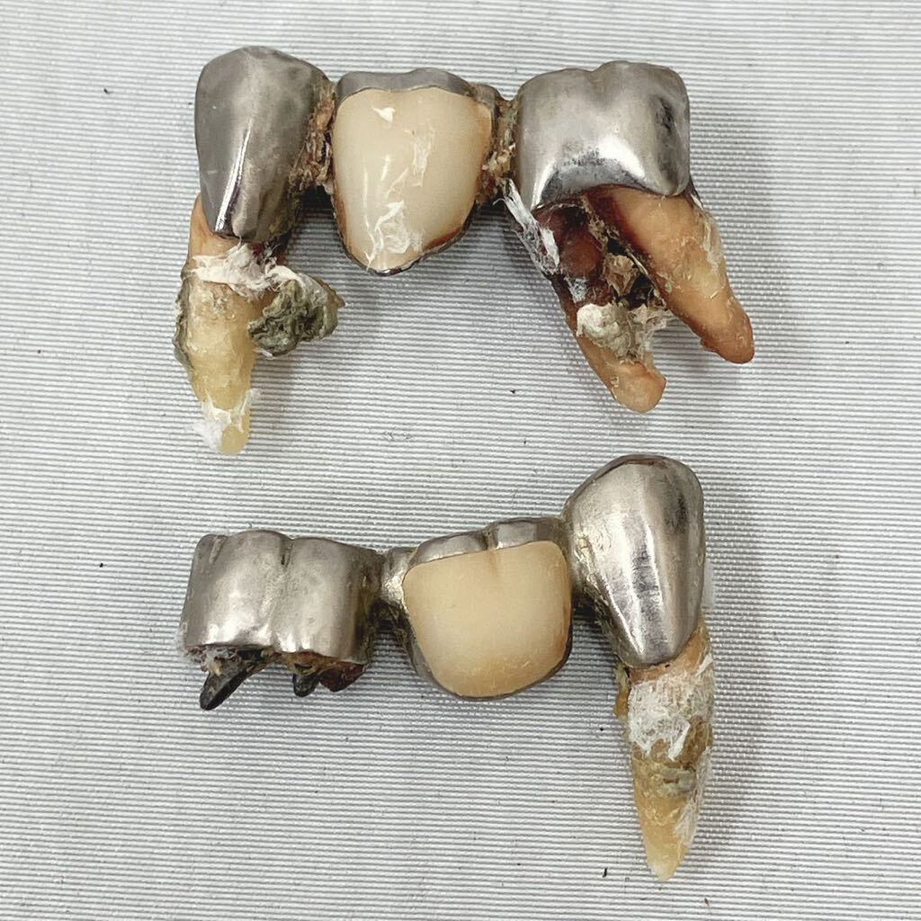 銀歯 約22ｇ 歯科 歯科技工 シルバー 銀 未鑑定 02-0319_画像4