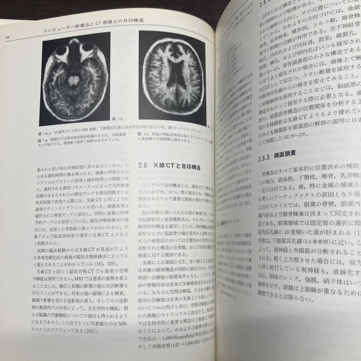 CT診断のための脳解剖と機能系 1986.10 訳・久留裕 真柳　初版【A21】_画像7