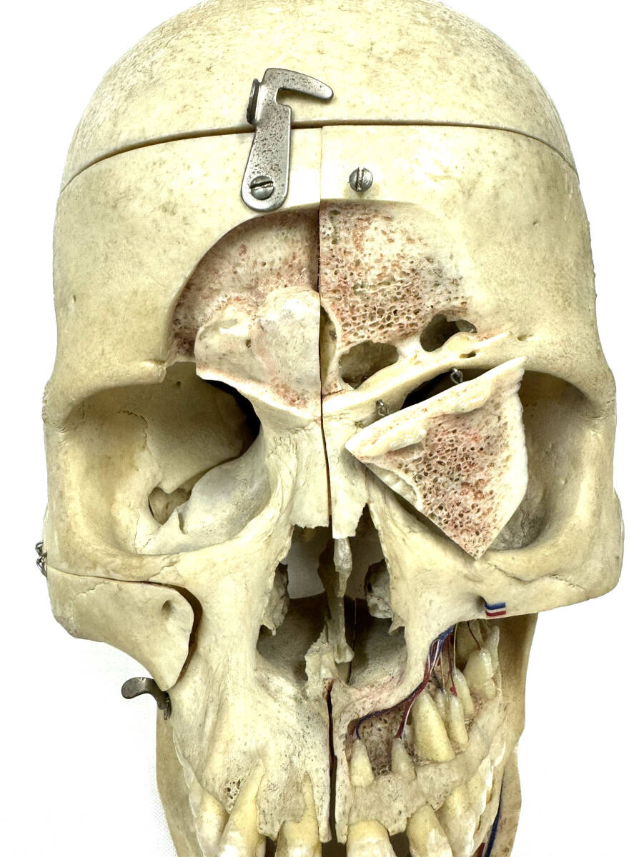 ■本物 骨格標本 医学・歯科■ 頭蓋骨 脳頭蓋 顔面頭蓋 顎関節 人骨 医療 資料 可動式 耳鼻科 整形外科の画像5
