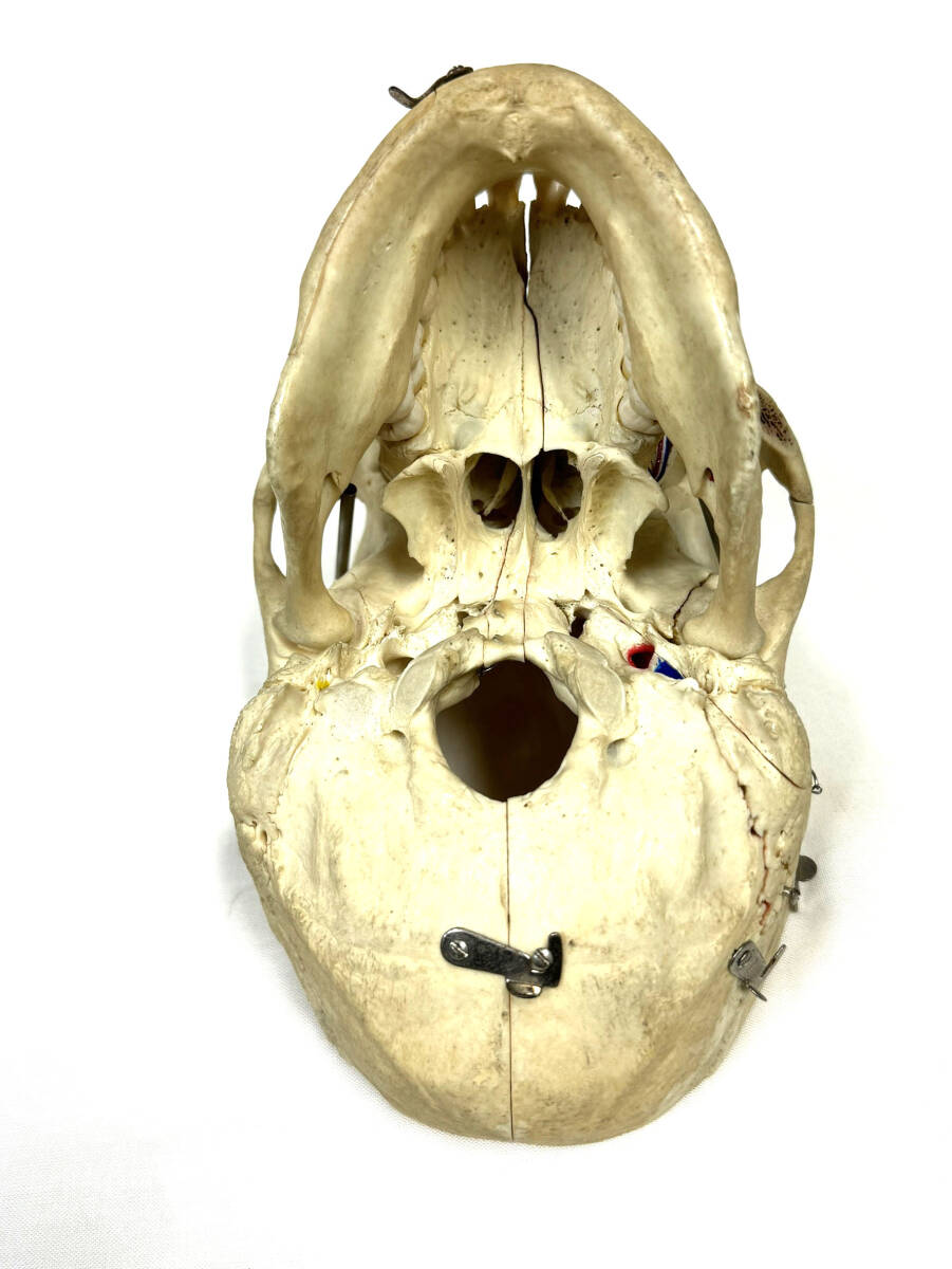■本物 骨格標本 医学・歯科■ 頭蓋骨 脳頭蓋 顔面頭蓋 顎関節 人骨 医療 資料 可動式 耳鼻科 整形外科の画像9