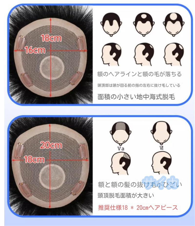 人毛100% ウィッグ メンズ トップウィッグ 頭頂部ウィッグ 部分ウィッグ 巻き髪　脱毛症 通気 薄毛 白髪隠し 自然 ゆるふわ F239_画像8