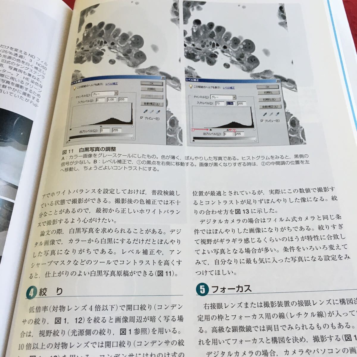 h-423 標準病理学 第4版 編集 坂本穆彦・北川昌伸・仁木利朗 医学書院※10_画像7