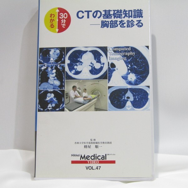 Nikkei　メディカルビデオ　VOL.47　30分でわかる　CTの基礎知識-胸部を見る_画像1