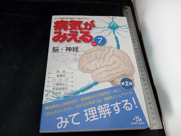 病気がみえる 脳・神経 第2版(vol.7) 医療情報科学研究所_画像1