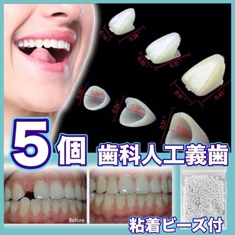 デンタル義歯 プラスチック義歯 テンポラリートゥース 前歯 ランダム５個 インスタントスマイル 差し歯 仮歯 付け歯 粘着ビーズ付 cの画像1