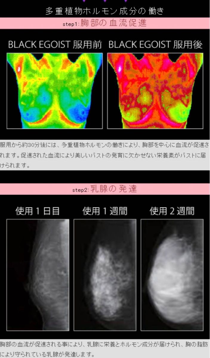 バストアップサプリ　豊胸　バストケア　バストアップ　ダイエットサプリ