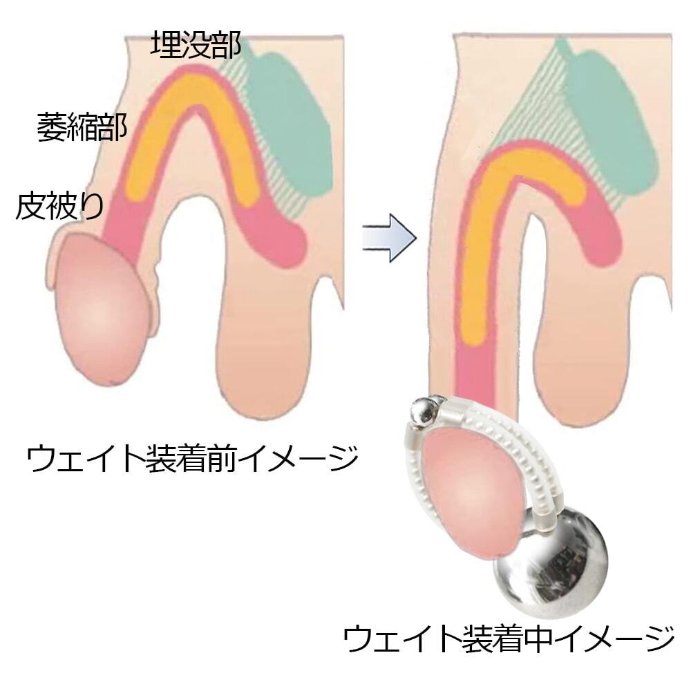 包茎対策&陰茎牽引リング クマッキーウェイト200CR 珠型/クロム鋼球錘付ペニス増大器具 強力磁石搭載チントレグッズ/落下防止ストラップ付_画像7