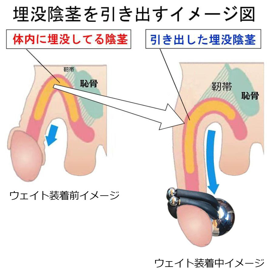 ペニス牽引リング クマッキーウェイト３００ ＣＲ ブラック 落下防止器具付 増大ストレッチ器具（増減用錘無）