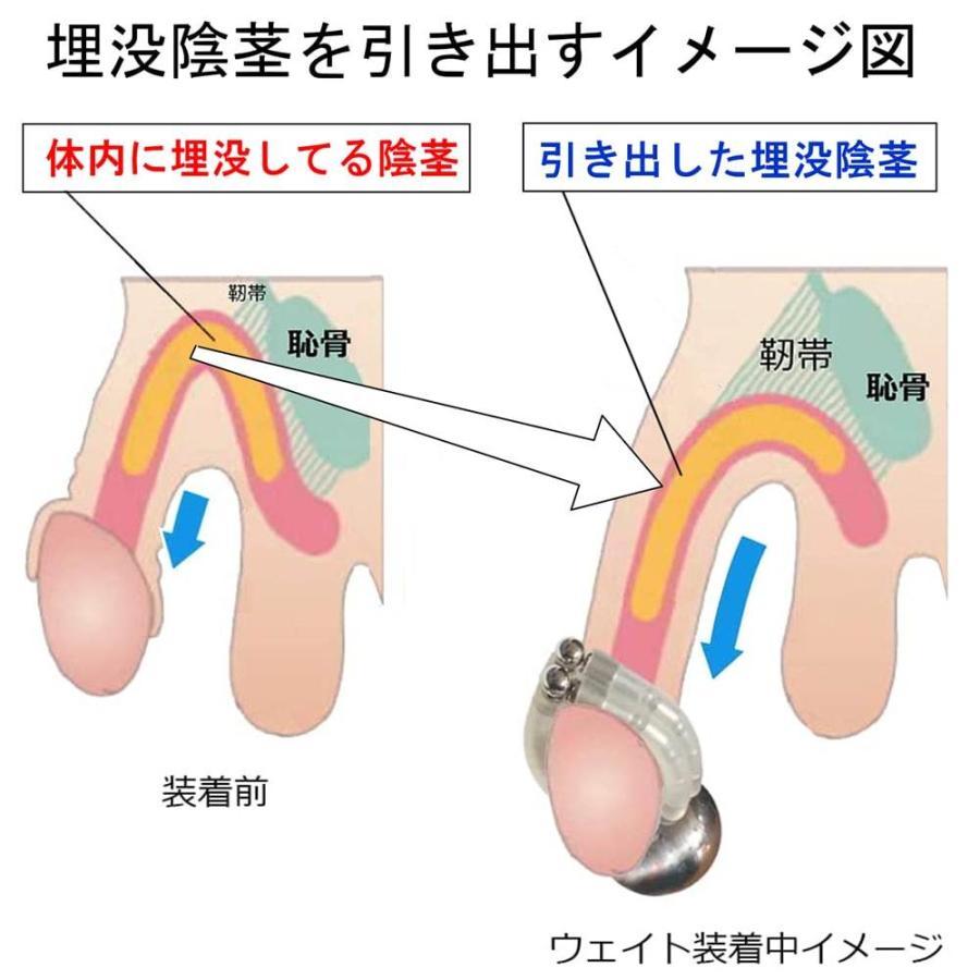 ペニス牽引リング クマッキーウェイト２００ 鎖型 増減用錘・落下防止器具付 増大ストレッチ器具