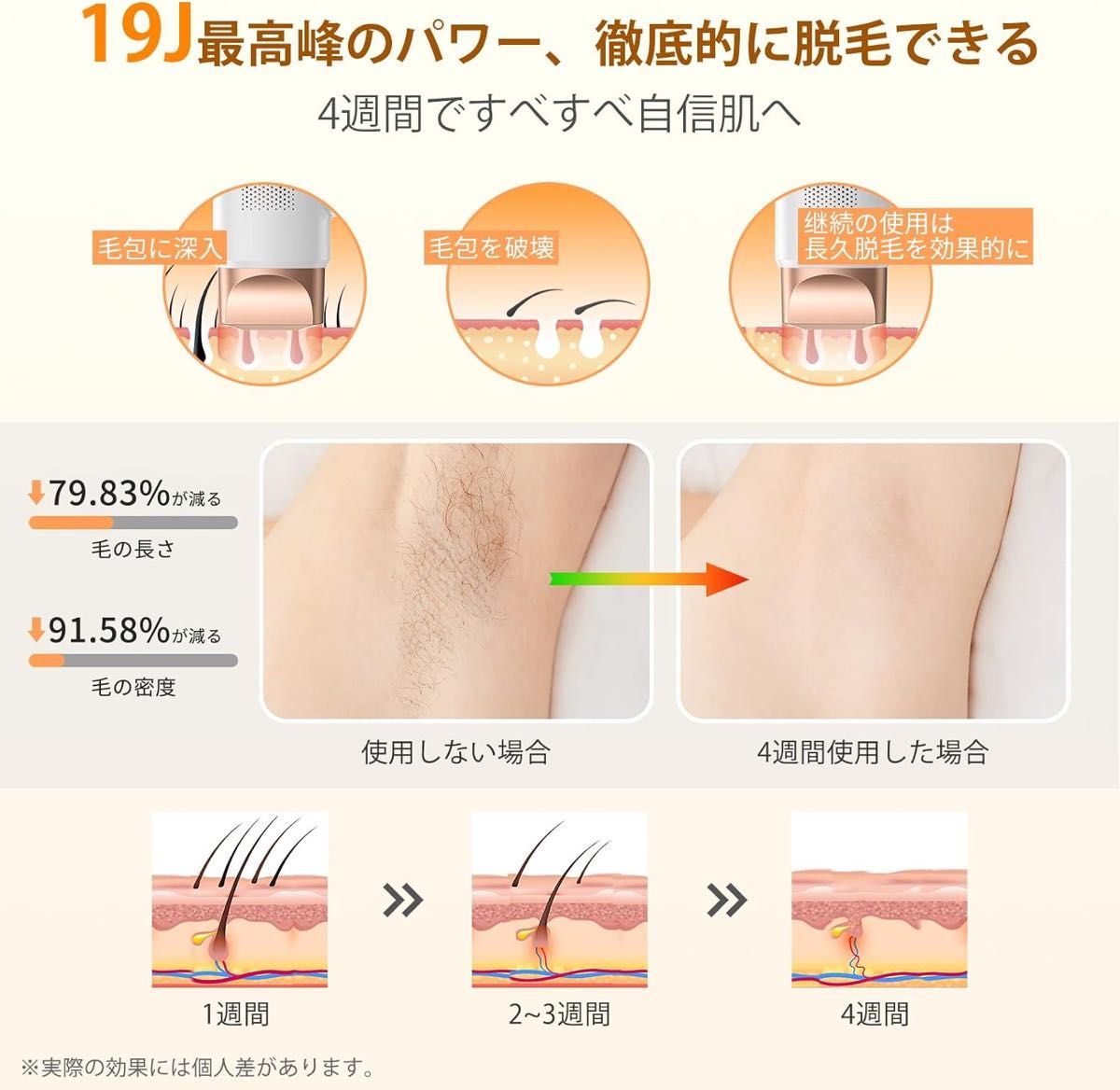 脱毛器 メンズ レディース vio対応 【2024最新サロン級IPL脱毛器無痛脱毛】 家庭用脱毛器 大画面タッチパネル搭載 