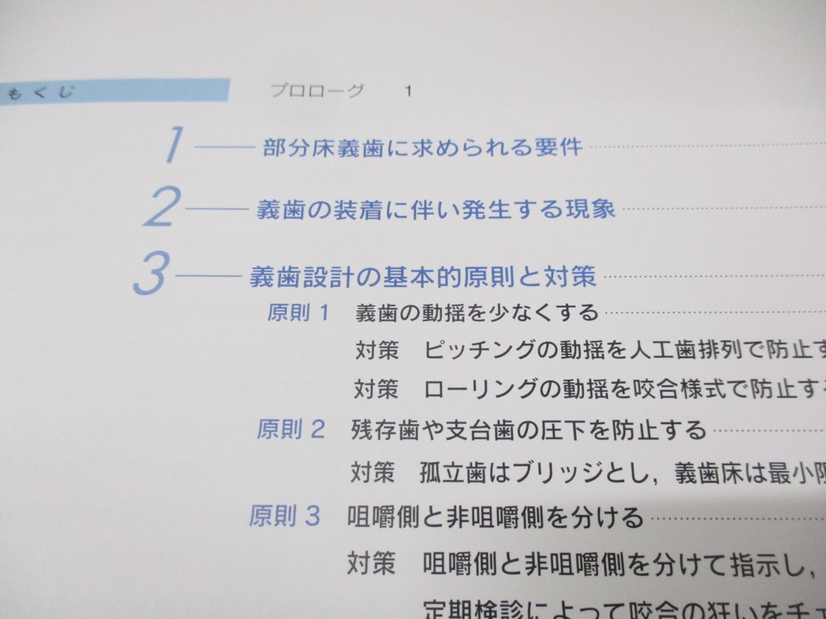 ●01)【同梱不可】部分床義歯の設計と咬合/インプラントより義歯で治す31提言/丹羽克味/学建書院/2013年発行/A_画像3